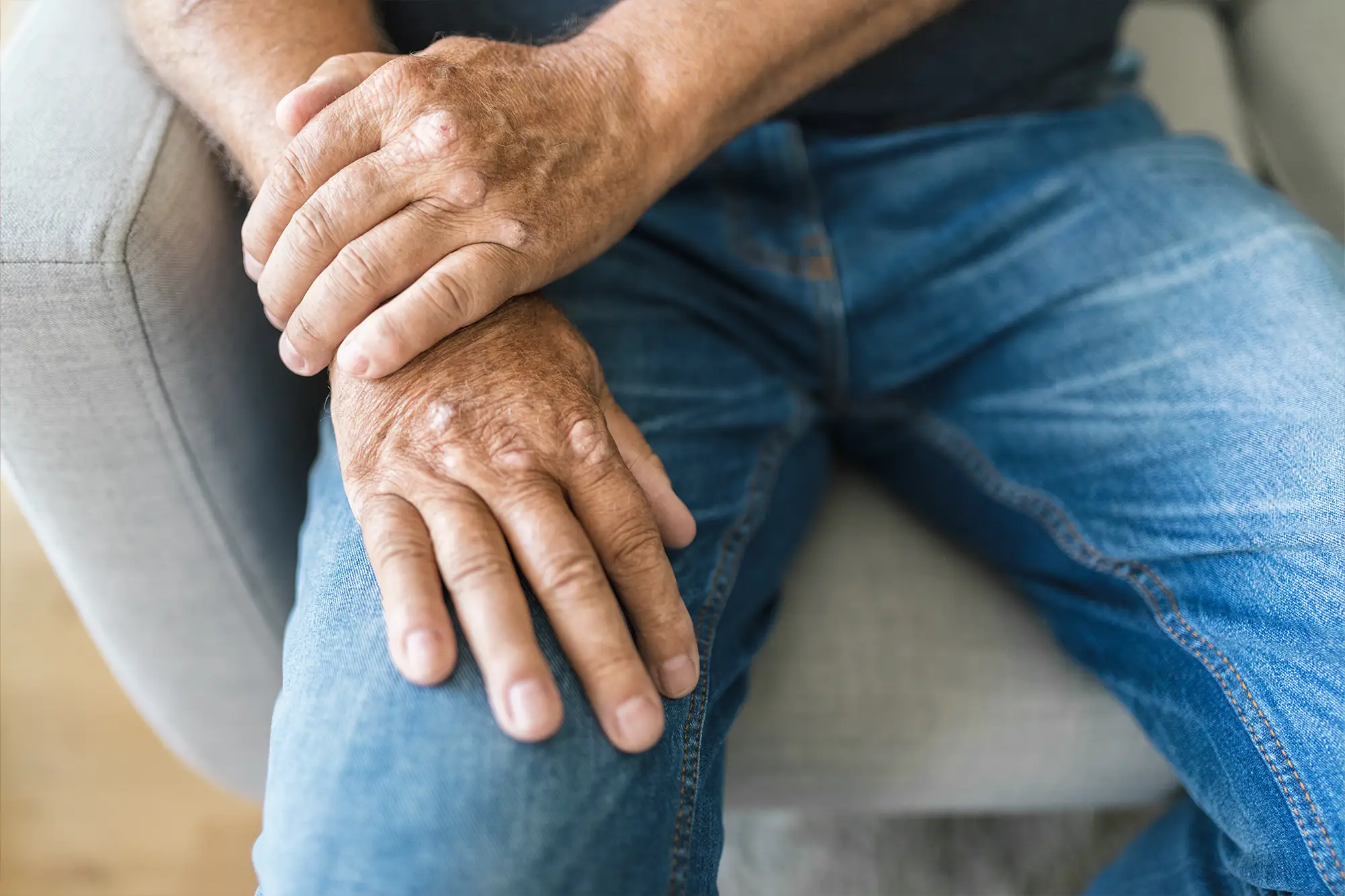 arthritis-